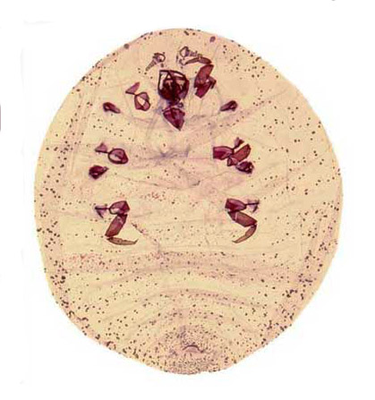   Dactylopius coccus  